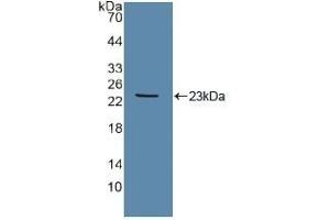 Detection of Recombinant Tie2, Human using Polyclonal Antibody to TEK Tyrosine Kinase, Endothelial (Tie2) (TEK antibody  (AA 286-465))