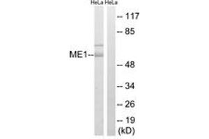 Western blot analysis of extracts from HeLa cells, using ME1 Antibody. (ME1 antibody  (AA 468-517))