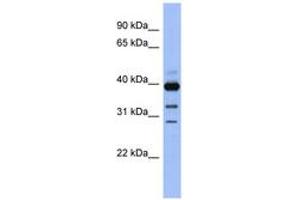 Image no. 1 for anti-Guanine Nucleotide Binding Protein (G Protein), alpha Activating Activity Polypeptide O (GNAO1) (AA 71-120) antibody (ABIN6743833) (GNAO1 antibody  (AA 71-120))