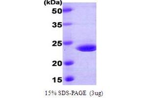 SDS-PAGE (SDS) image for CASP2 and RIPK1 Domain Containing Adaptor with Death Domain (CRADD) (AA 1-199) protein (His tag) (ABIN667087)