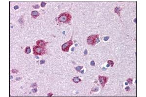 Human Brain, Cortex: Formalin-Fixed, Paraffin-Embedded (FFPE) (MFSD2A antibody  (C-Term))