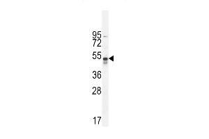 hTNFR-p (ABIN655093 and ABIN2844728) western blot analysis in A549 cell line lysates (35 μg/lane). (TNFR-S274 (AA 252-281) antibody)