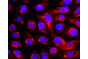 SK-OV-3 cells were fixed with paraformaldehyde, permeabilized with 0. (ADAM17 antibody)