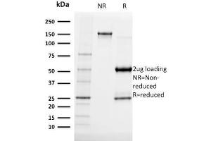 SDS-PAGE Analysis Purified Albumin Mouse Monoclonal Antibody (ALB/2141). (Albumin antibody)