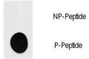 Dot blot analysis of phospho-S6K antibody. (RPS6KB1 antibody  (pSer418))
