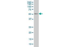 PEPD monoclonal antibody (M01), clone 1D5-H3 Western Blot analysis of PEPD expression in HepG2 . (PEPD antibody  (AA 1-493))