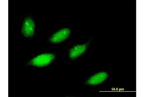 Immunofluorescence of purified MaxPab antibody to ZNF653 on HeLa cell. (ZNF653 antibody  (AA 1-615))