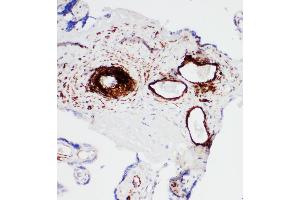 Anti-SERCA1 ATPase antibody, IHC(P) IHC(P): Human Placenta Tissue (ATP2A1/SERCA1 antibody  (Middle Region))