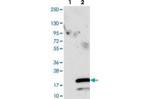 Western blot analysis of Lane 1: Negative control (vector only transfected HEK293T lysate). (SPCS1 antibody)