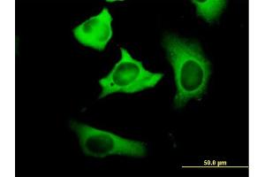Immunofluorescence of purified MaxPab antibody to FASN on HeLa cell.