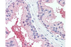 Anti-CADM2 antibody IHC of human prostate. (CADM2 antibody  (Extracellular Domain))