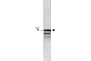 Western blot analysis of Prph in whole rat brain stem homogenate using Prph polyclonal antibody  (1 : 20,000). (Peripherin antibody)