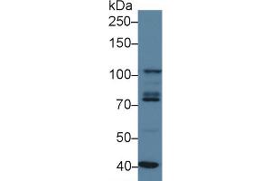 Western blot analysis of Human K562 cell lysate, using Human STAT2 Antibody (3 µg/ml) and HRP-conjugated Goat Anti-Rabbit antibody (