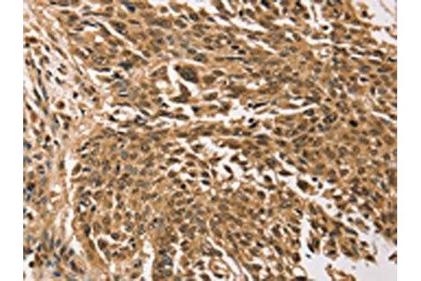 Transglutaminase 7 antibody