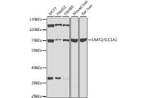Western blot analysis of extracts of various cell lines, using E/E/SLC1 antibody (ABIN6129469, ABIN6147870, ABIN6147871 and ABIN6214022) at 1:1000 dilution. (SLC1A2 antibody  (AA 495-574))
