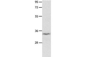 Western Blot analysis of Mouse brain tissue using IGFBP7 Polyclonal Antibody at dilution of 1:400 (IGFBP7 antibody)