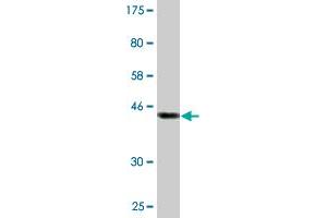 Western Blot detection against Immunogen (45. (ASRGL1 antibody  (AA 1-180))