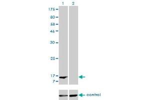 Western blot analysis of FABP1 over-expressed 293 cell line, cotransfected with FABP1 Validated Chimera RNAi (Lane 2) or non-transfected control (Lane 1). (FABP1 antibody  (AA 1-127))