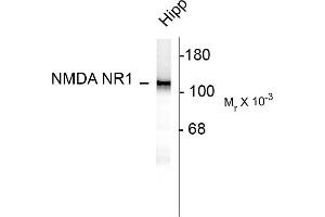 Western blots of 10 ug of rat hippocampal (Hipp) lysate showing specific immunolabeling of the ~120k NR1 subunit of the NMDA receptor. (GRIN1/NMDAR1 antibody  (AA 1-564))