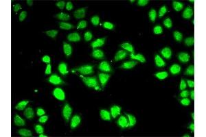 Immunofluorescence (IF) image for anti-Proteasome (Prosome, Macropain) 26S Subunit, ATPase, 3 (PSMC3) antibody (ABIN1874383) (PSMC3 antibody)
