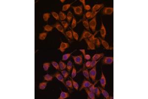 Immunofluorescence analysis of HeLa cells using UBQLNL antibody (ABIN7271125) at dilution of 1:100. (UBQLNL antibody  (AA 176-475))