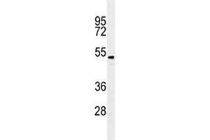 TGFB2 antibody