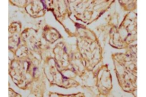 IHC image of ABIN7127445 diluted at 1:230 and staining in paraffin-embedded human placenta tissue performed on a Leica BondTM system. (Recombinant Aromatase antibody)