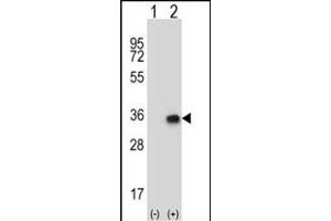 Western blot analysis of CNOT8 (arrow) using rabbit polyclonal CNOT8 Antibody (N-term) (ABIN656816 and ABIN2846030). (CNOT8 antibody  (N-Term))