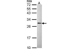 WB Image Sample (30 ug of whole cell lysate) A: Hep G2 , 12% SDS PAGE antibody diluted at 1:1000 (DCXR antibody  (C-Term))