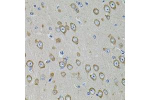 Immunohistochemistry of paraffin-embedded rat brain using PDE1B antibody. (PDE1B antibody  (AA 190-536))