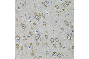 Immunohistochemistry of paraffin-embedded rat brain using PDE1B antibody.