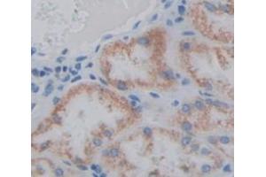 Figure. (STAR antibody  (AA 1-285))