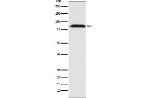 Western blot analysis of Furin expression in HepG2 cell lysate.
