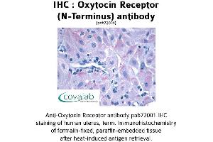 Image no. 1 for anti-Oxytocin Receptor (OXTR) (Extracellular Domain), (N-Term) antibody (ABIN1737739)