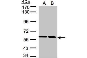 SRPR anticorps  (Center)