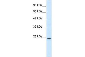 WB Suggested Anti-HOXB6 Antibody Titration: 0.