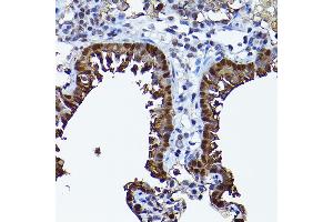 Immunohistochemistry (IHC) image for anti-SEC14-Like 2 (SEC14L2) (AA 60-270) antibody (ABIN6147484)