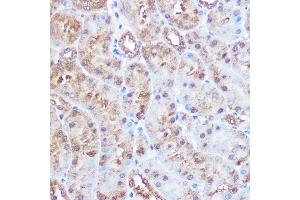 Immunohistochemistry of paraffin-embedded mouse kidney using ERK5 Rabbit mAb (ABIN1680723, ABIN3018327, ABIN3018328 and ABIN7101595) at dilution of 1:100 (40x lens). (MAPK7 antibody)