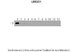 Lanes:   1: 40ng HIS-UBE2D1 protein 2: 40ng HIS-UBE2D2 protein 3: 40ng HIS-UBE2D3 protein 4: 40ng HIS-UBE2D4 protein 5: 40ng HIS-UBE2E1 protein 6: 40ng HIS-UBE2E2 protein 7: 40ng HIS-UBE2E3 protein 8: 40ng HIS-UBE2K protein 9: 40ng HIS-UBE2L3 protein 10: 40ng HIS-UBE2N protein 11: 40ng HIS-UBE2V1 protein 12: 40ng HIS-UBE2V2 protein. (UBE2D1 antibody  (Middle Region))