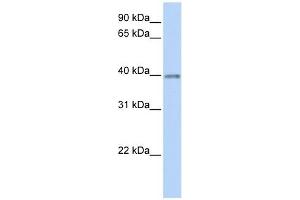 Opticin antibody used at 1 ug/ml to detect target protein. (OPTC antibody  (C-Term))