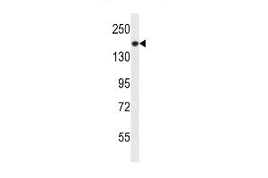 Western Blotting (WB) image for anti-Phosphatidylinositol-3,4,5-Trisphosphate-Dependent Rac Exchange Factor 1 (PREX1) (AA 1134-1163), (C-Term) antibody (ABIN656506)