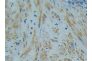 Immunohistochemistry (IHC) image for anti-Tumor Necrosis Factor Receptor Superfamily, Member 1A (TNFRSF1A) (AA 60-236) antibody (ABIN7436807)