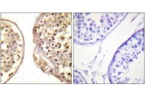 Immunohistochemistry analysis of paraffin-embedded human testis tissue, using c-Jun (Ab-231) Antibody. (C-JUN antibody  (AA 201-250))