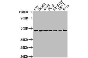Western Blot Positive WB detected in: U87 whole cell lysate, HepG2 whole cell lysate, A549 whole cell lysate, PC-3 whole cell lysate, SH-SY5Y whole cell lysate, THP-1 whole cell lysate, Hela whole cell lysate All lanes: NDRG1 antibody at 1:2000 Secondary Goat polyclonal to rabbit IgG at 1/50000 dilution Predicted band size: 43, 36, 34 kDa Observed band size: 43 kDa (NDRG1 antibody  (AA 136-394))