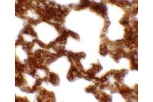 Immunohistochemical analysis of NETO1 in rat lung tissue with NETO1 polyclonal antibody  at 2.