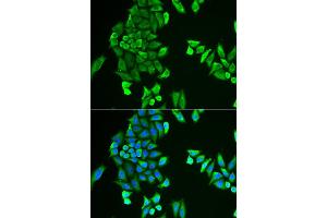 Immunofluorescence analysis of HeLa cell using ACSS2 antibody. (ACSS2 antibody)