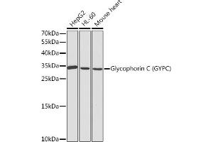 Western blot analysis of extracts of various cell lines, using Glycophorin C (Glycophorin C (GYPC)) antibody (ABIN3021795, ABIN3021796, ABIN3021797 and ABIN6215928) at 1:1000 dilution. (CD236/GYPC antibody  (AA 1-128))