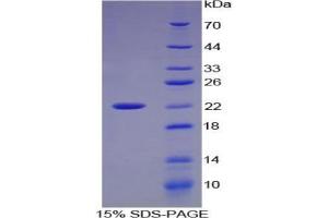 SDS-PAGE analysis of Cow Matrix Metalloproteinase 9 (MMP9) Protein. (MMP 9 Protein)