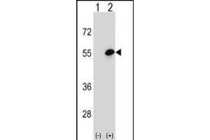 Western blot analysis of COCH (arrow) using rabbit polyclonal COCH Antibody (Center) (ABIN656833 and ABIN2846042). (COCH antibody  (AA 399-428))