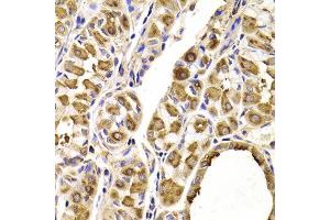 Immunohistochemistry of paraffin-embedded Human gastric using SEPT2 antibody at dilution of 1:100 (x400 lens). (Septin 2 antibody)